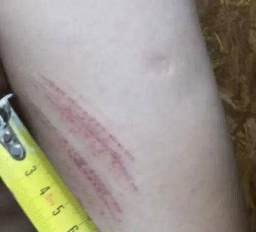 侄女与姑姑争祖父留下的门面，长沙租客“躺枪”：我被打了，店也被锁了！