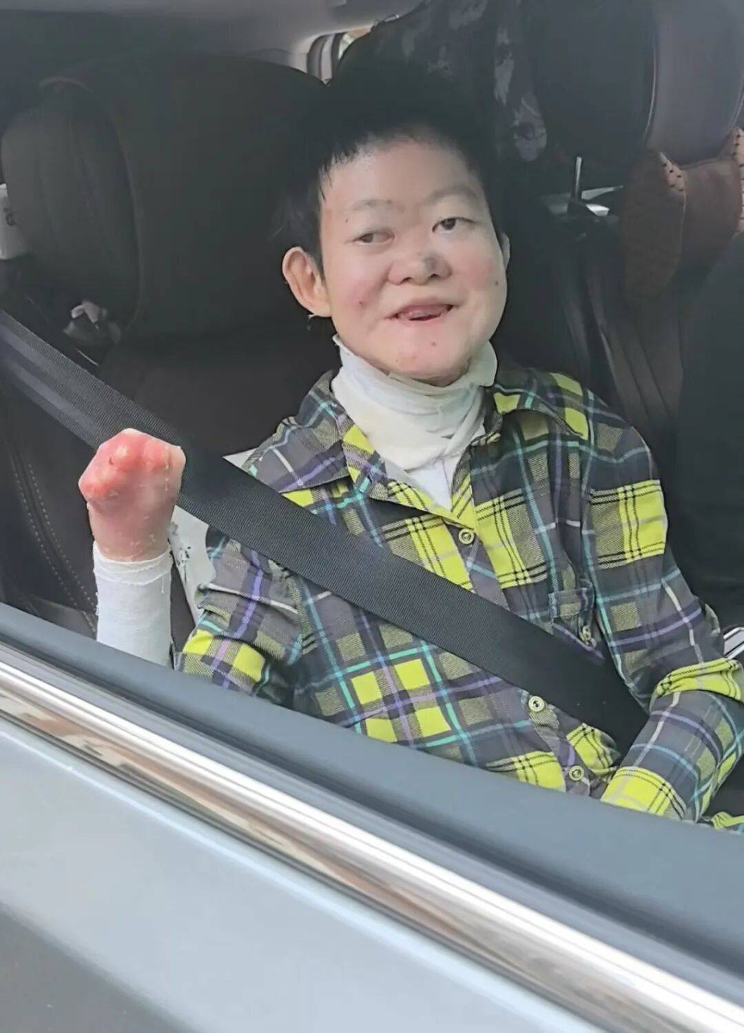 医生断言“活不过2岁”的郑州罕见病女孩,24岁“带伤出征”,开启西藏之行