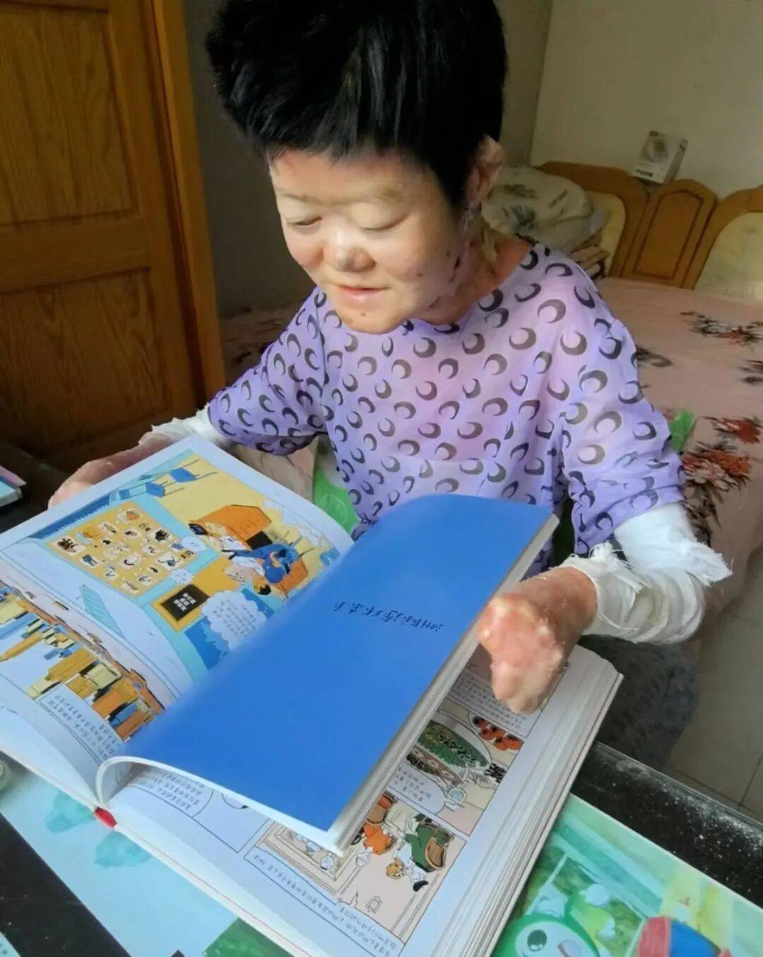 医生断言“活不过2岁”的郑州罕见病女孩,24岁“带伤出征”,开启西藏之行