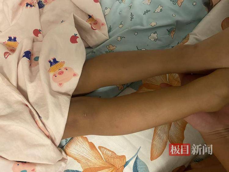 沈阳一女婴出生半年确诊“脊柱裂”，宝妈称“大排畸”正常，涉事医师无产前诊断资质，当地卫健委介入