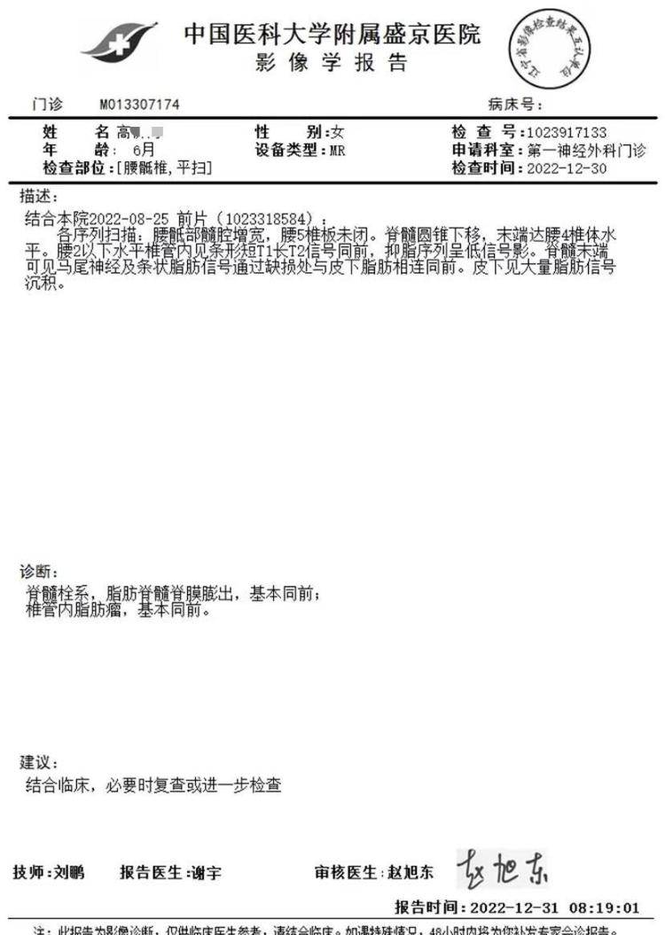 沈阳一女婴出生半年确诊“脊柱裂”，宝妈称“大排畸”正常，涉事医师无产前诊断资质，当地卫健委介入